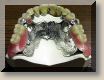 Prothse Dentaire Attachements CM-Box