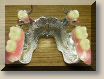 Prothse Dentaire Attachements CM-Box